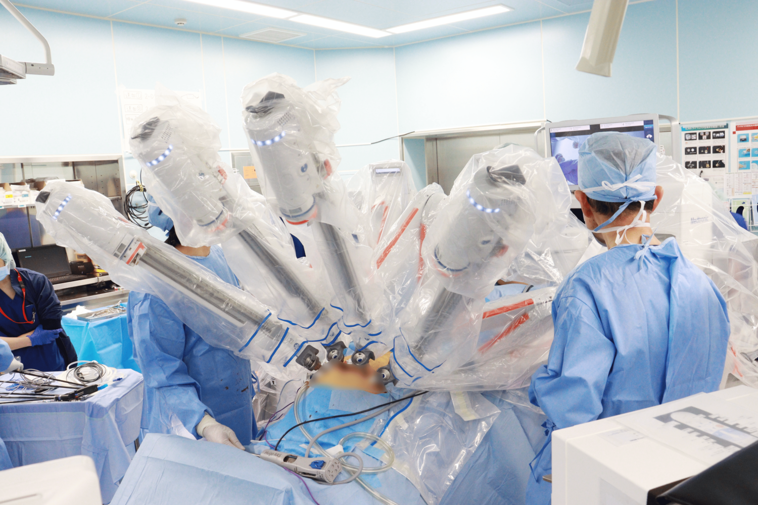 ロボット支援下子宮全摘手術