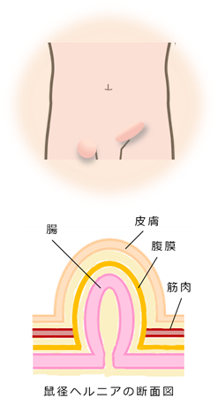 そけいヘルニアセンター 新松戸中央総合病院