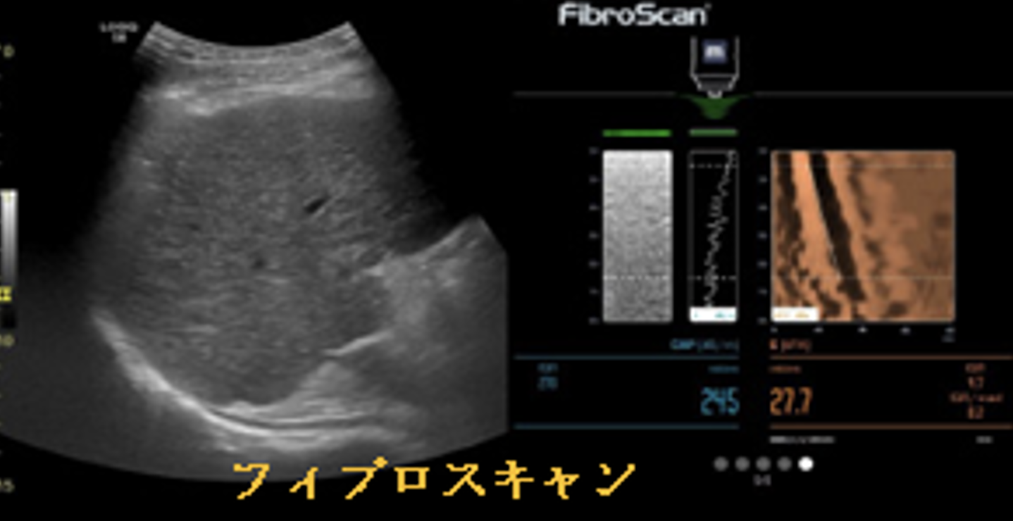 超音波診断装置 | 新松戸中央総合病院