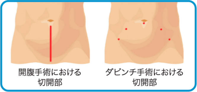 傷口が小さい